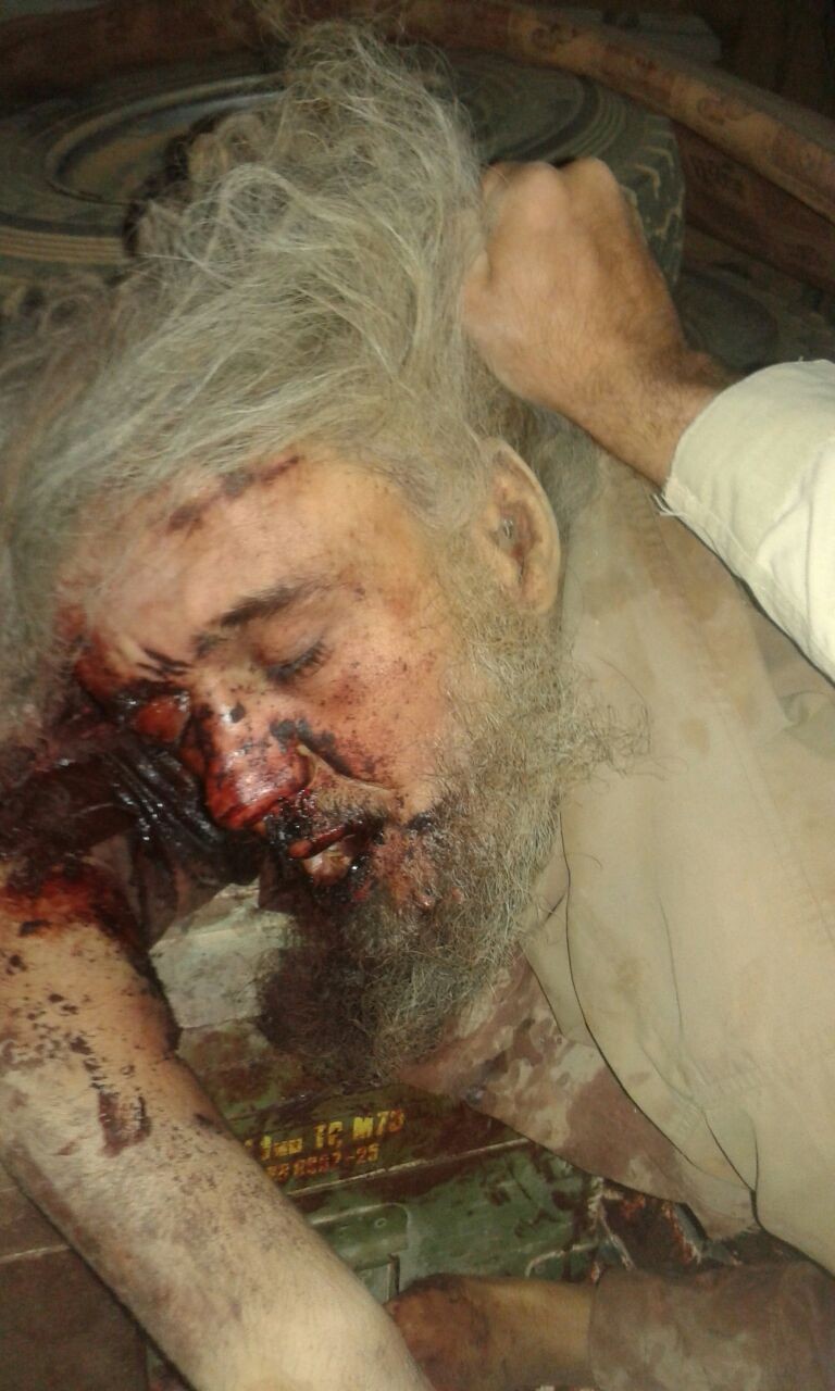Casualty photograph