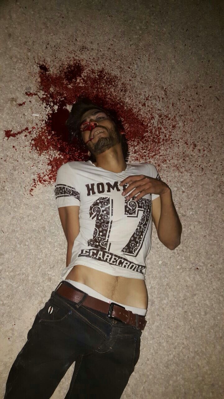 Casualty photograph